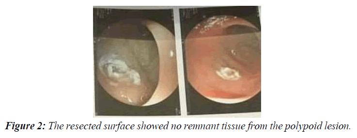 gastroenterology-digestive-diseases-sigmoid-colon