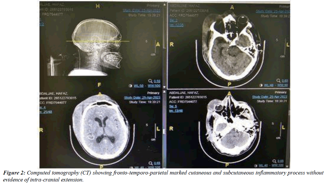 ophthalmic-and-eye-research-computed-tomography