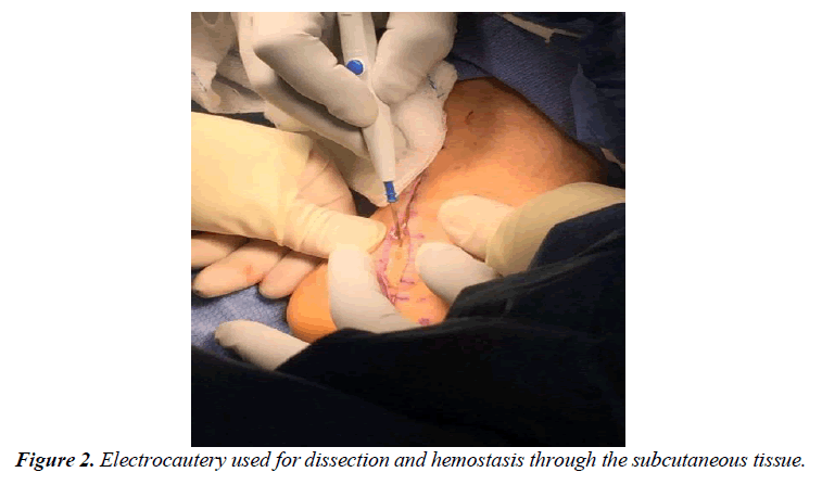 orthopedic-surgery-rehabilitation-achilles-tendon