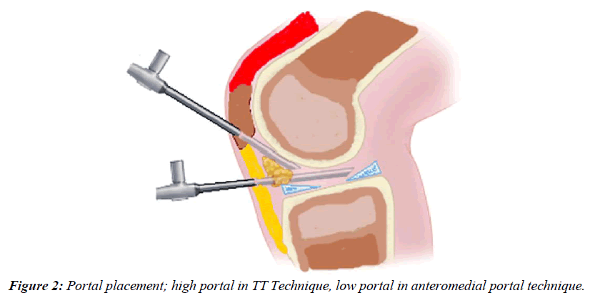 orthopedic-surgery-rehabilitation-cruciate-ligament