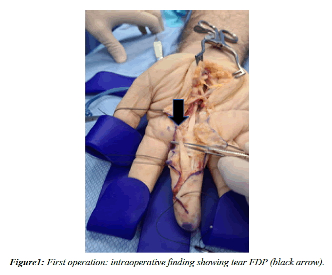 orthopedic-surgery-rehabilitation-intraoperative