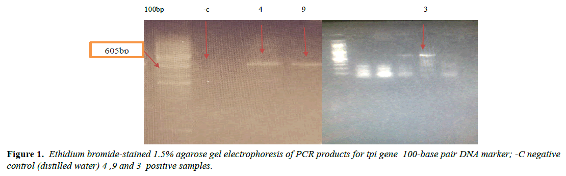 parasitic-diseases-diagnosis-distilled-water