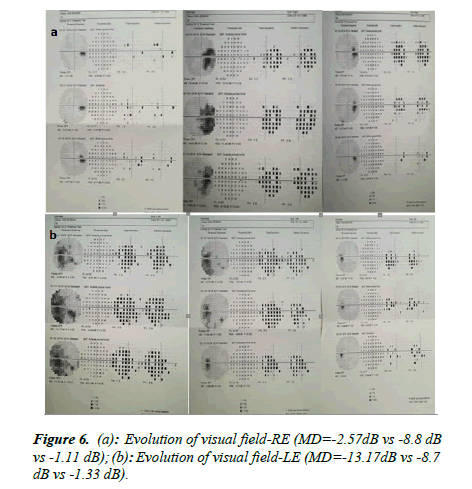 Ophthalmology-Case-Evolution