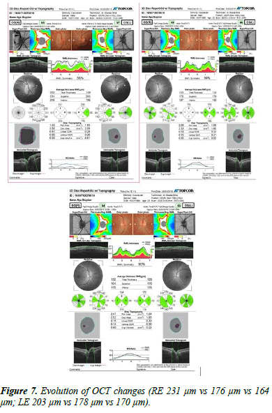 Ophthalmology-Case-OCT