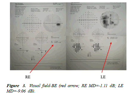 Ophthalmology-Case-Visual