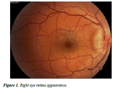 Ophthalmology-Case-retina