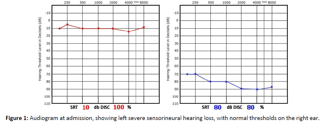 Otolaryngology-Audiogram