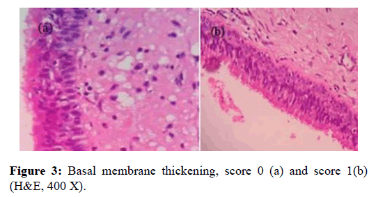 Otolaryngology-Basal-membrane