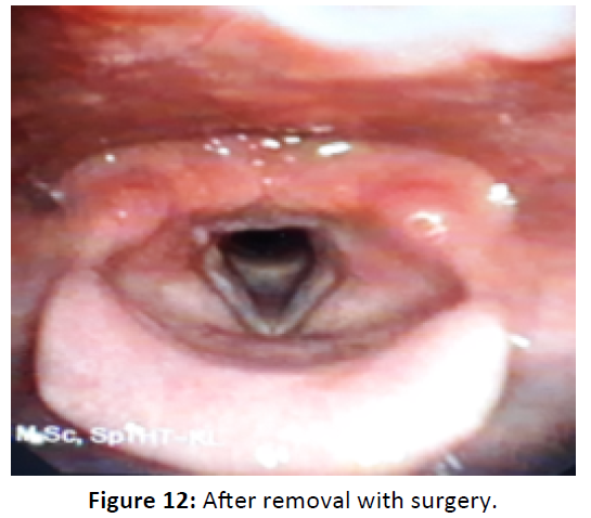 Otolaryngology-Before-treatment