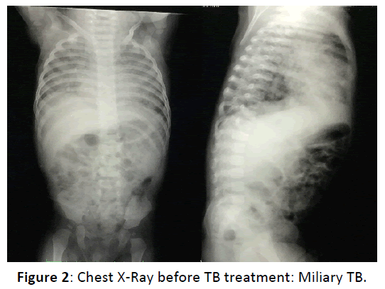 Otolaryngology-Chest-X-Ray