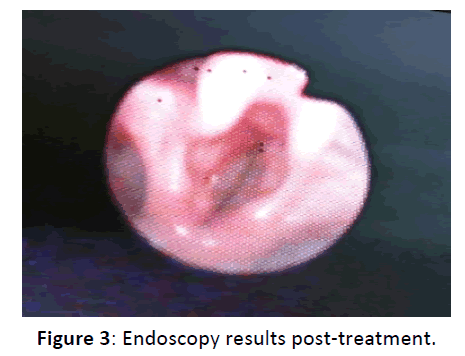 Otolaryngology-Endoscopy