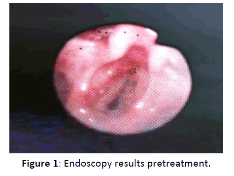 Otolaryngology-Endoscopy-results