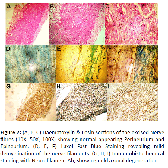 Otolaryngology-Eosin-sections