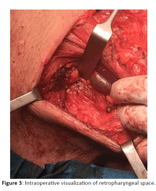 Otolaryngology-Intraoperative-visualization