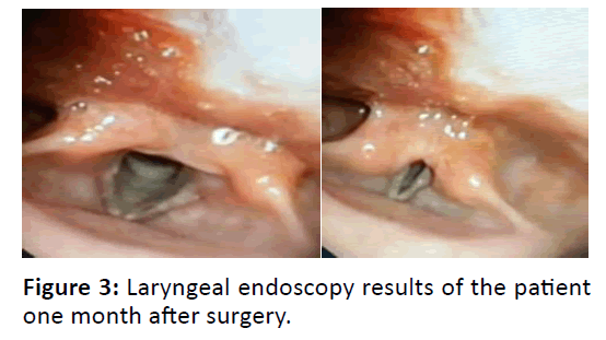 Otolaryngology-Laryngeal-endoscopy