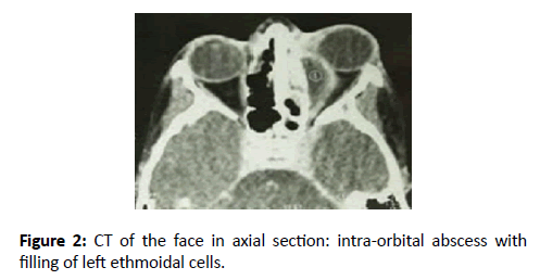 Otolaryngology-Nasal-axial-section