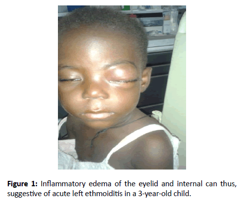 Otolaryngology-Nasal-year-old