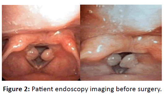Otolaryngology-Patient-endoscopy