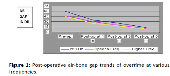 Otolaryngology-air-bone-gap