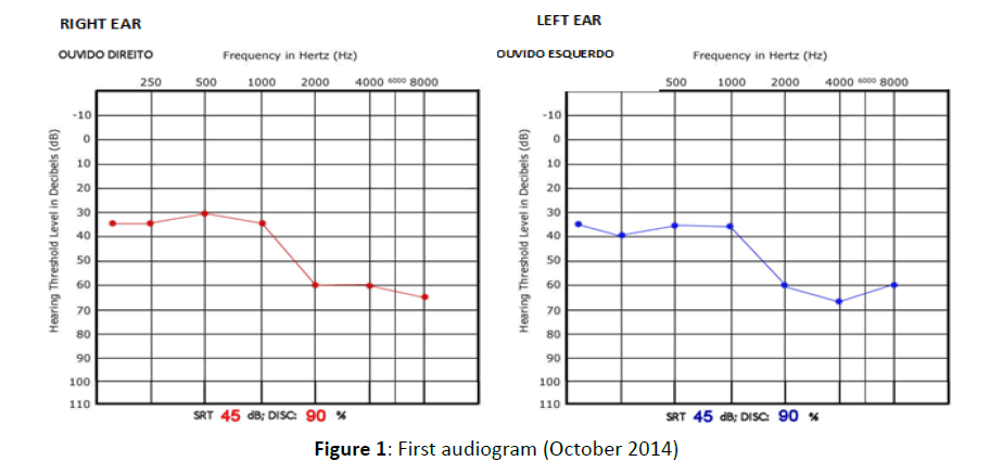 Otolaryngology-audiogram