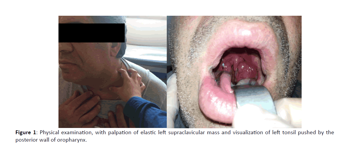 Otolaryngology-elastic-left