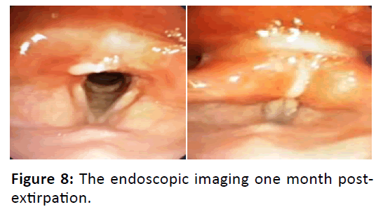 Otolaryngology-endoscopic