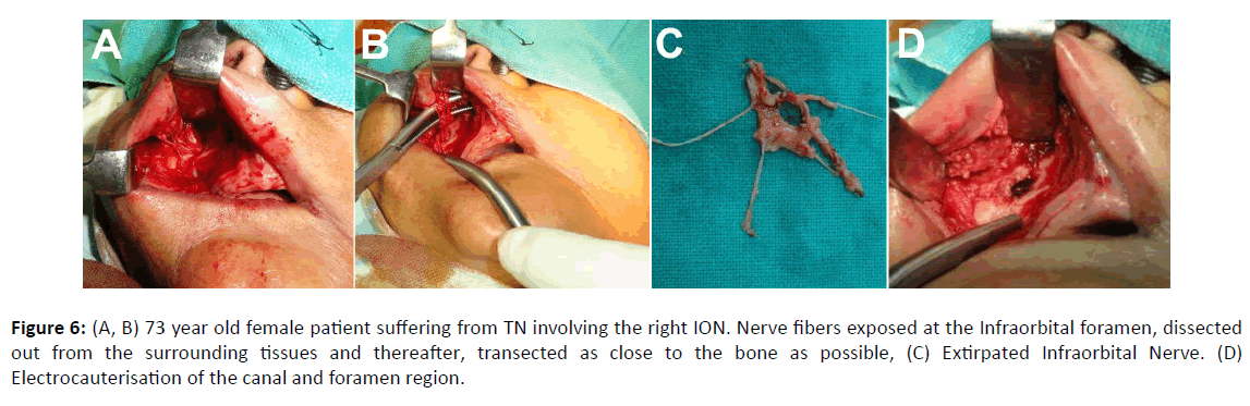 Otolaryngology-female-patient