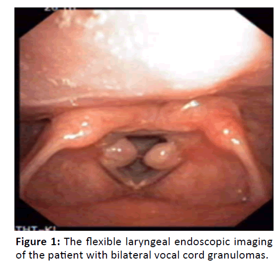 Otolaryngology-flexible-laryngeal