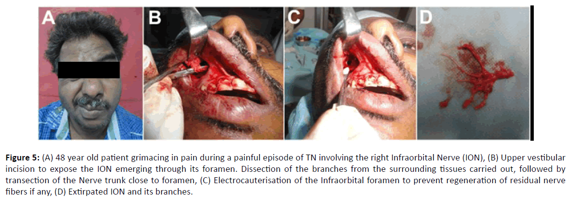 Otolaryngology-old-patient