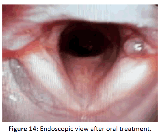 Otolaryngology-oral-treatment