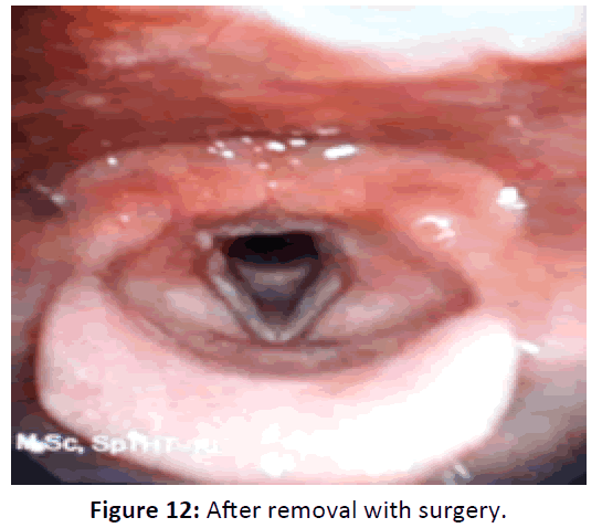 Otolaryngology-surgery