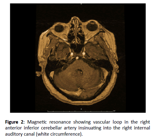 Otolaryngology-vascular