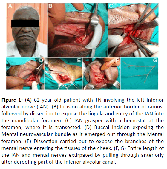 Otolaryngology-year-old