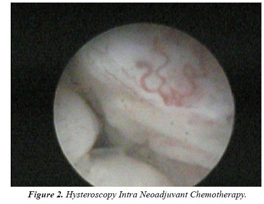 Surgical-Research-Neoadjuvant-Chemotherapy