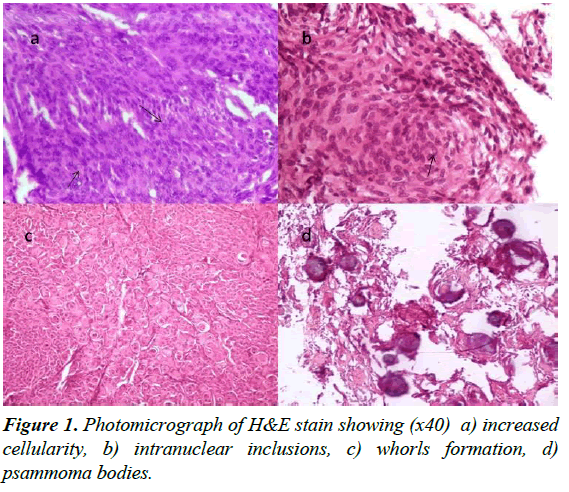 advanced-surgical-research-whorls-formation