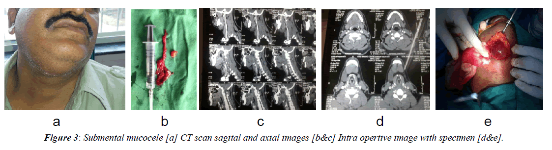 advanced-surgical-scan-sagital