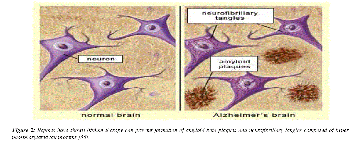 advances-cell-science-neurofibrillary-tangles