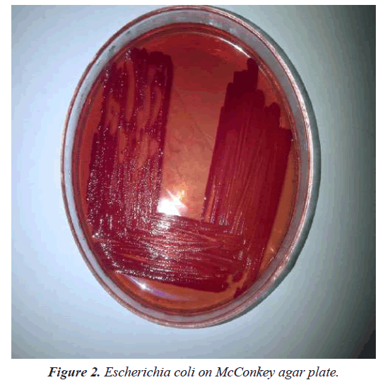 agricultural-science-botany-coli-agar