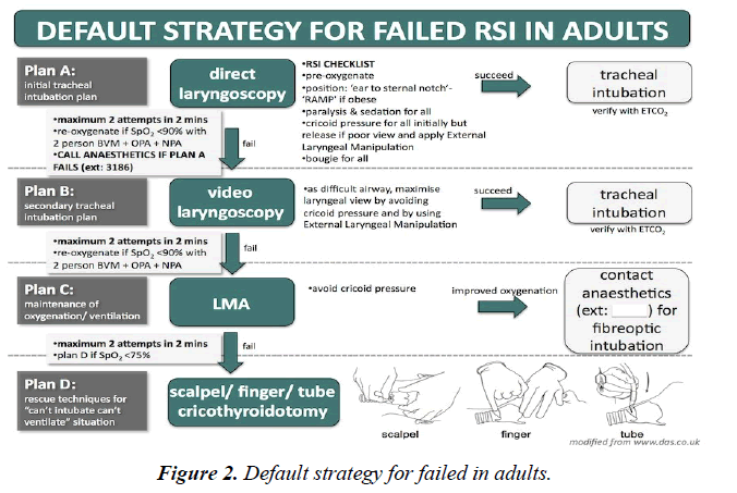 anesthetics-anesthesiology-Default-strategy-failed-adults