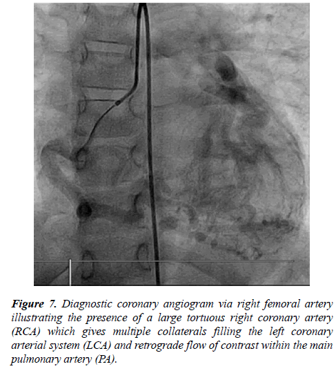 annals-cardiovascular-Diagnostic-coronary