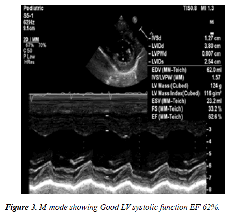 annals-cardiovascular-LV-systolic