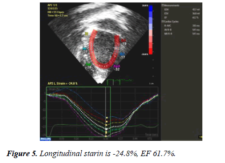 annals-cardiovascular-Longitudinal-starin