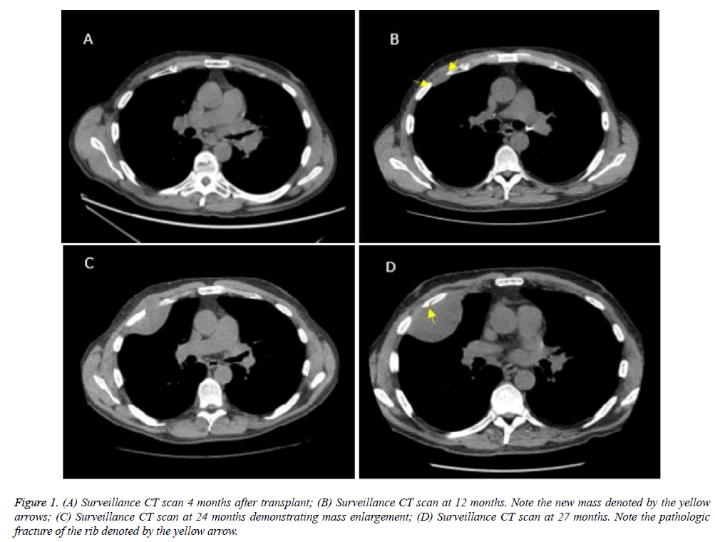 annals-cardiovascular-Surveillance-CT