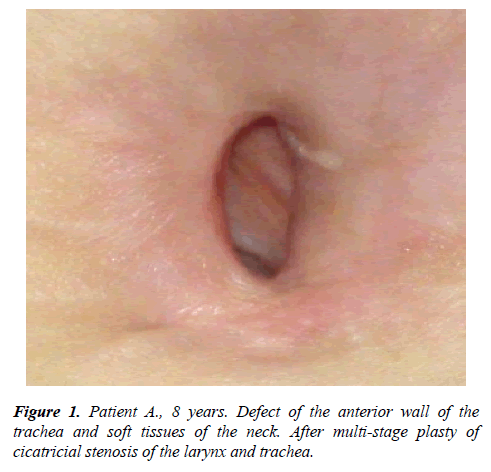 annals-cardiovascular-anterior-wall