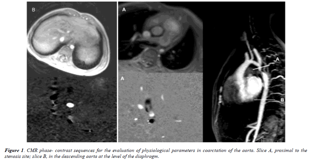 annals-cardiovascular-contrast-sequences