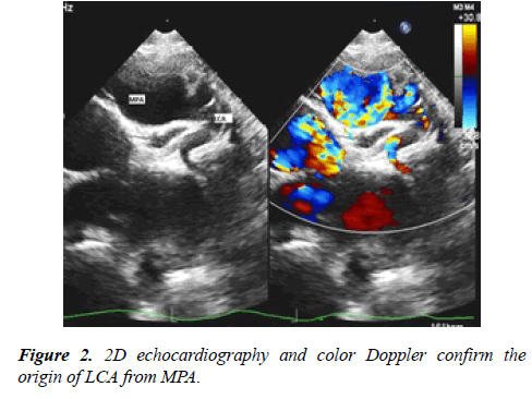 annals-cardiovascular-echocardiography