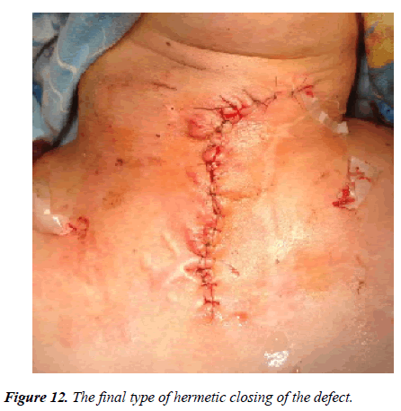 annals-cardiovascular-hermetic-closing