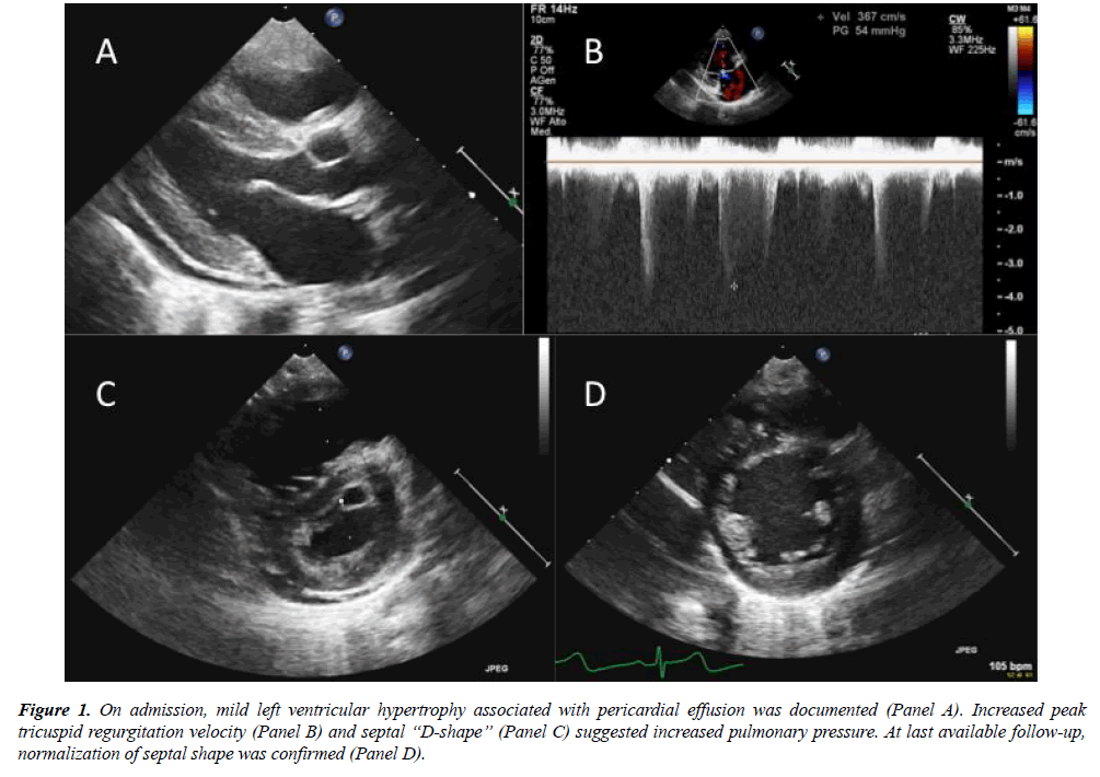 annals-cardiovascular-left-ventricular