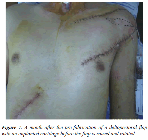 annals-cardiovascular-pre-fabrication