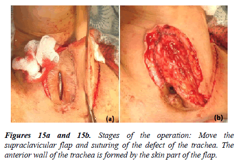 annals-cardiovascular-skin-part